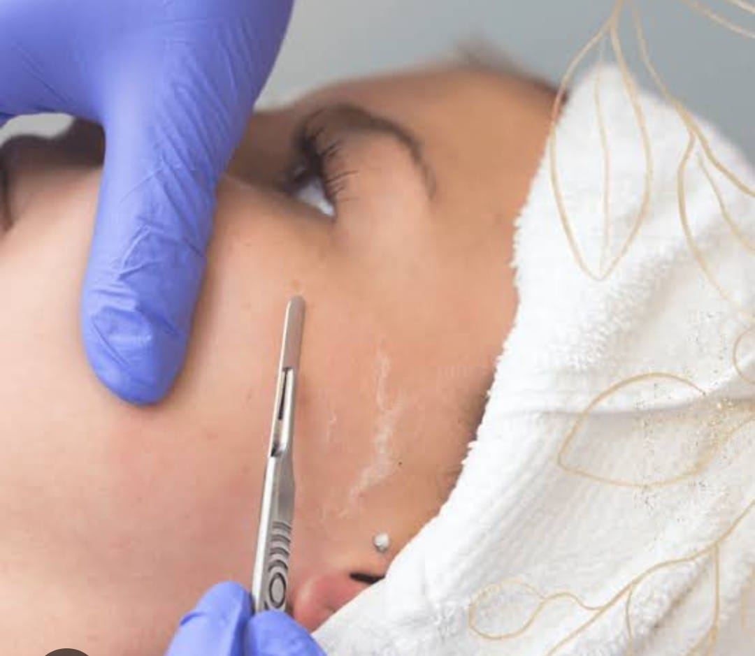 Dermaplaning Facial
