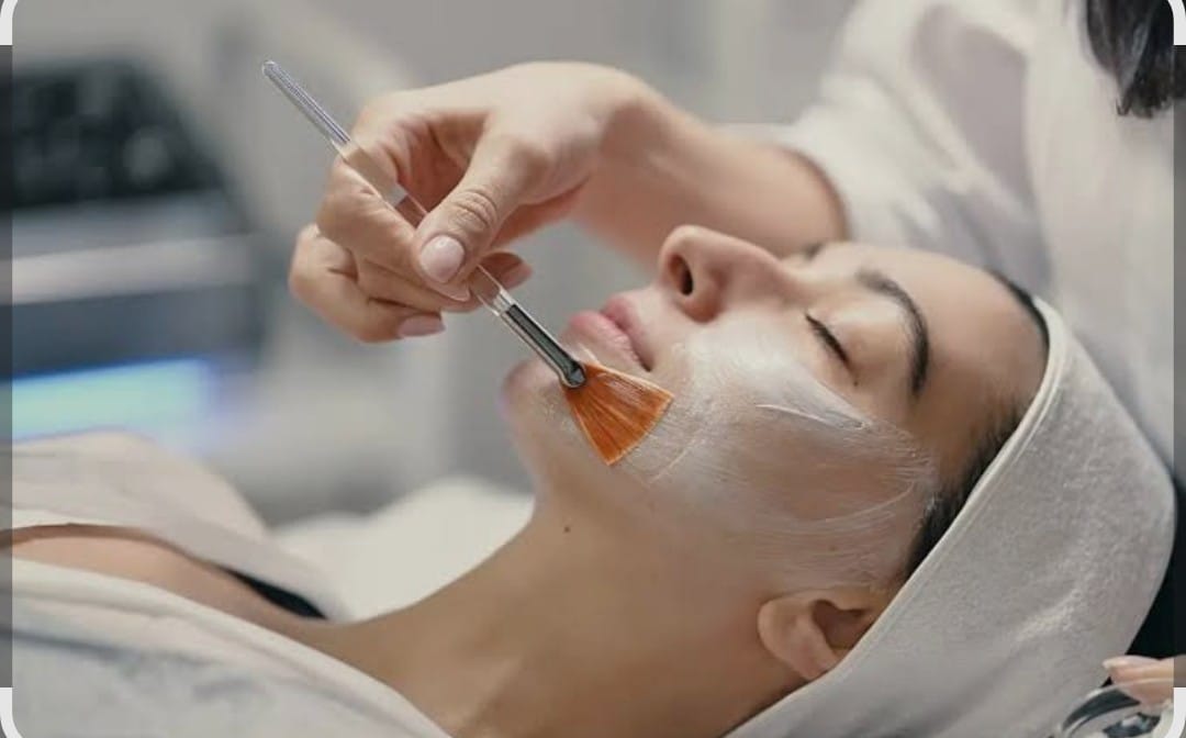 Peeling Químico